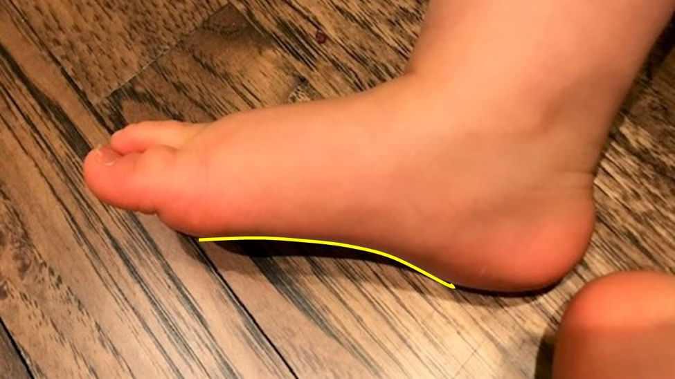 Flexible flat outlet feet